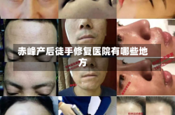 赤峰产后徒手修复医院有哪些地方