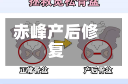 赤峰产后修复