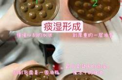 剖腹产痒擦什么