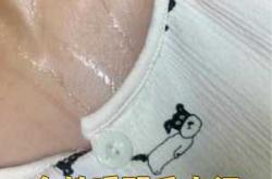 产后吃饭出汗是怎么回事