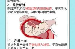 剖腹产多久完全不疼