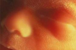 怀孕八个月能不能染头发