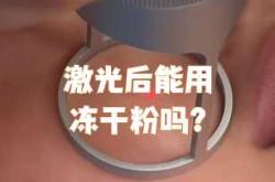 皮肤激光治疗影响备孕吗