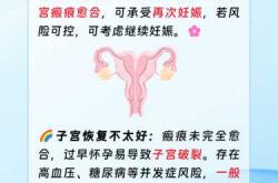 剖腹产是在哪一年出现的