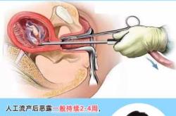 产后恶露多久能排干净