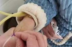 哪里能看婴儿输液图片