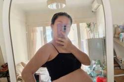 青岛妇幼剖腹产需要多少钱