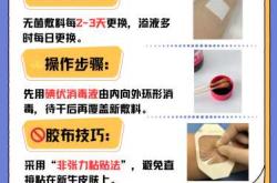 产后缝针处红肿怎么办