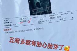 做CT后多久可以怀孕