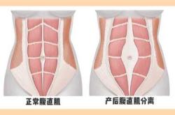 产后妈妈图片都有哪些类型