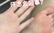 产后脚多汗是什么原因