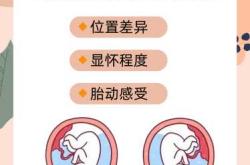 前壁要剖腹产吗