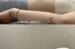 产后胳膊粗如何瘦