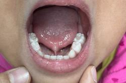 婴儿老是申舌头是怎么回事