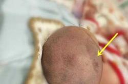 婴儿出生头长多少合适