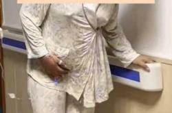 剖腹产后如何排除恶露