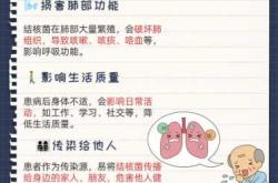 婴儿会得肺结核吗