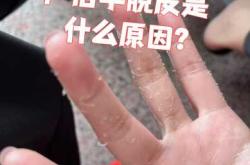 产后过敏性皮炎怎么办