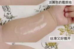 婴儿皮肤起皮是何原因