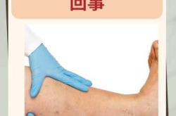 产后血液循环不好有啥症状