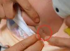 尿不湿会导致屁股张吗