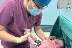 剖腹产真的很恐怖吗