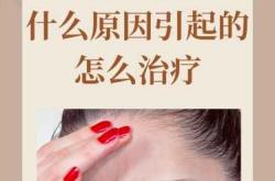 剖腹产后头疼究竟是啥原因