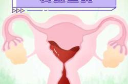 剖腹产后恶露黑怎么回事