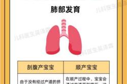 剖腹产一般都有谁陪着