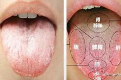 产后舌苔厚白如何调理