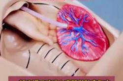 产后胎盘残留怎么办