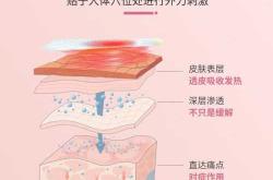 产后修复哪个品牌最好