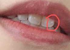 婴儿手指发黑怎么回事