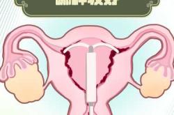 带着环怀孕孩子能要吗