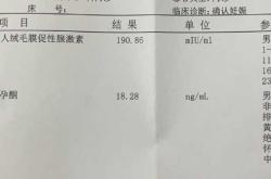 尿检能查出怀孕多久时间吗