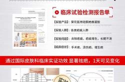 产后妊辰纹可以去除吗