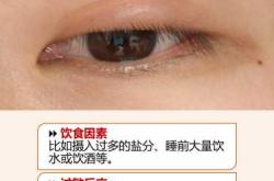 婴儿眼睑红肿是怎么回事