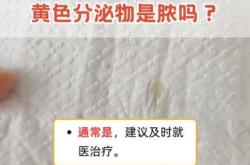 产后乳头有脓怎么办