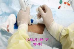 产后镇痛针真的安全有效吗