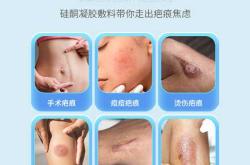 剖腹产修复疤痕膏真的有用吗