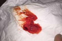 产后70天断断续续有血咋回事