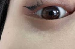 为什么产后会掉睫毛