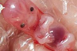 流产后大哭是怎么回事