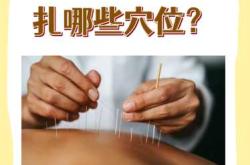 备孕能不能扎针灸治疗