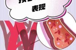 婴儿缺锌有啥症状表现