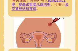 促卵泡素升高备孕原因是什么