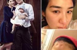 流产后暴瘦是怎么回事