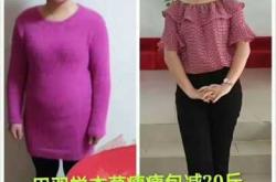 用瘦瘦包怀孕孩子能要吗