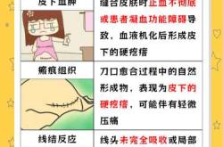 剖腹产伤口破裂怎么办