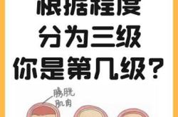 产后漏尿有哪些常见症状